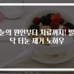 티눈의 원인부터 치료까지! 발바닥 티눈 제거 노하우
