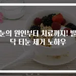티눈의 원인부터 치료까지! 발바닥 티눈 제거 노하우