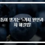 혜톱이 생기는 5가지 원인과 즉시 해결법!
