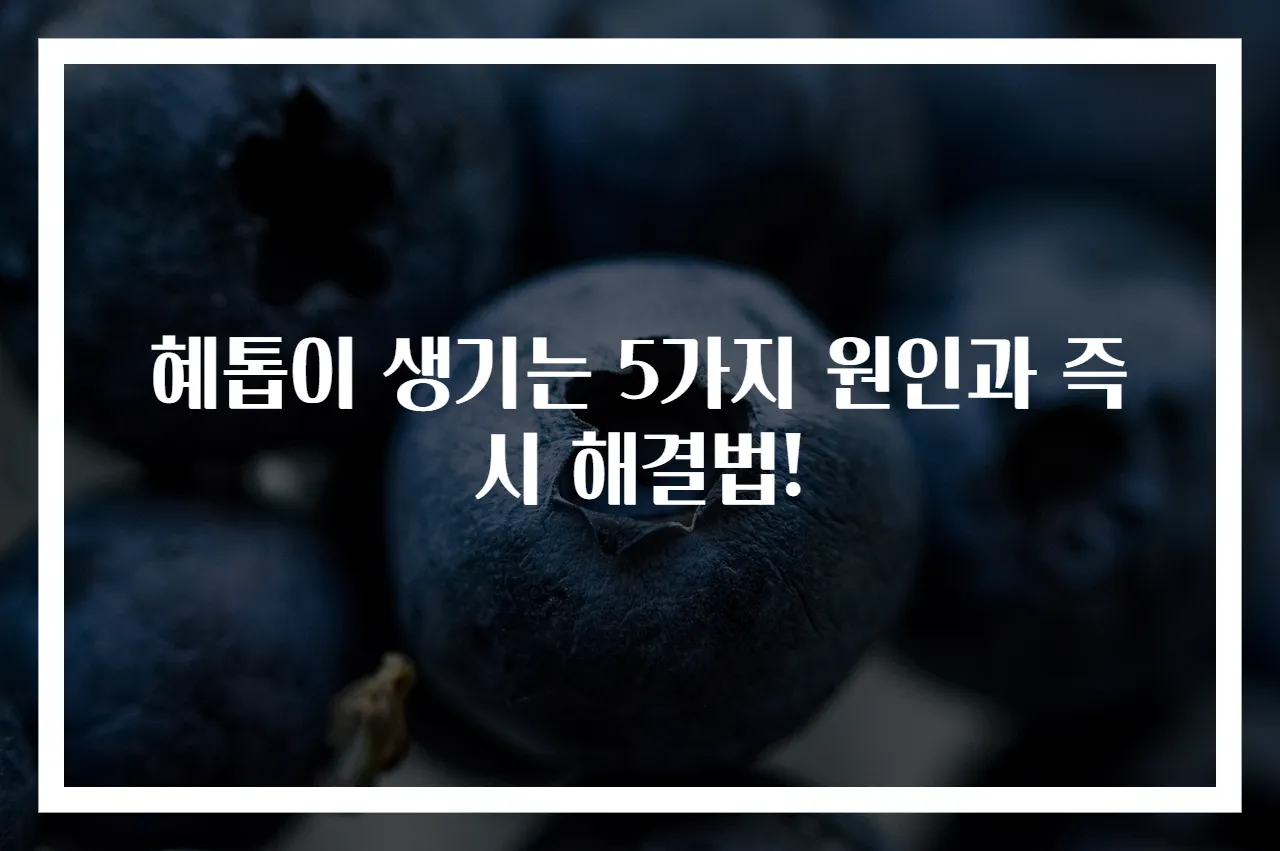 혜톱이 생기는 5가지 원인과 즉시 해결법!