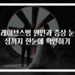 그레이브스병 원인과 증상 눈증상까지 한눈에 확인하기