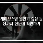 그레이브스병 원인과 증상 눈증상까지 한눈에 확인하기