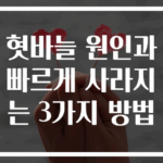혓바늘 원인과 빠르게 사라지는 3가지 방법