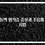 경동맥 협착증 증상과 초음파 검사법