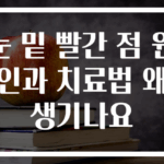 눈 밑 빨간 점 원인과 치료법 왜 생기나요