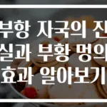 부항 자국의 진실과 부황 멍의 효과 알아보기