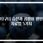사타구니 습진과 곰팡이 원인과 치료법 5가지