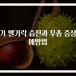 아기 발가락 습진과 무좀 증상과 예방법