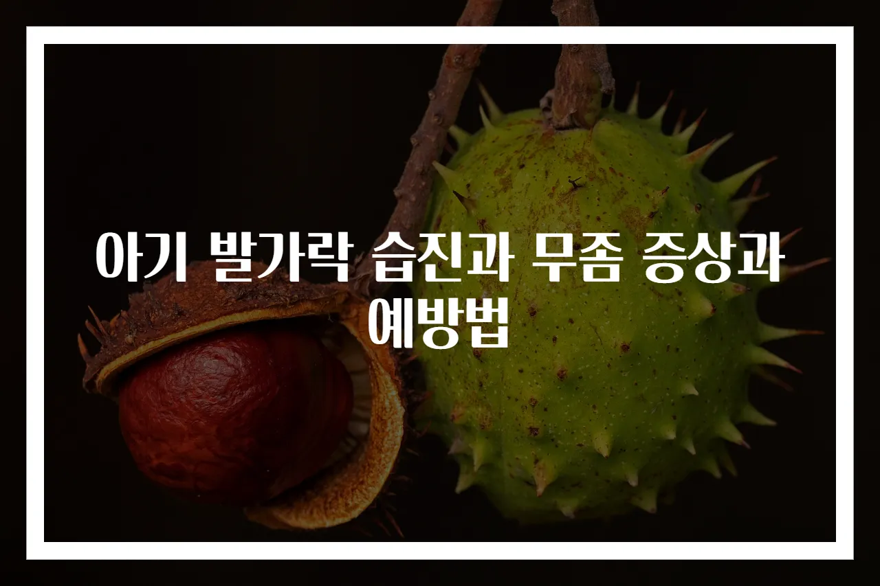 아기 발가락 습진과 무좀 증상과 예방법