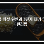 목 쥐젖 원인과 3단계 제거 및 관리법