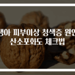 신생아 피부이상 청색증 원인과 산소포화도 체크법