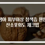 신생아 피부이상 청색증 원인과 산소포화도 체크법