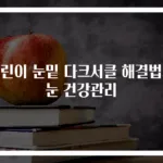 어린이 눈밑 다크서클 해결법과 눈 건강관리