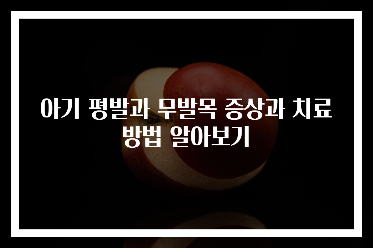 아기 평발과 무발목 증상과 치료 방법 알아보기