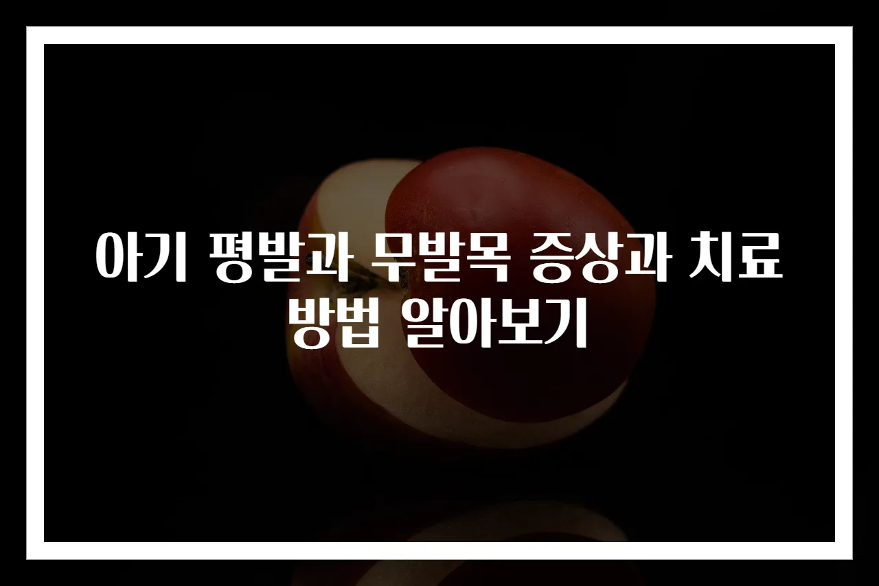 아기 평발과 무발목 증상과 치료 방법 알아보기