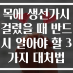 목에 생선가시 걸렸을 때 반드시 알아야 할 3가지 대처법